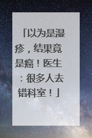以为是湿疹，结果竟是癌！医生：很多人去错科室！